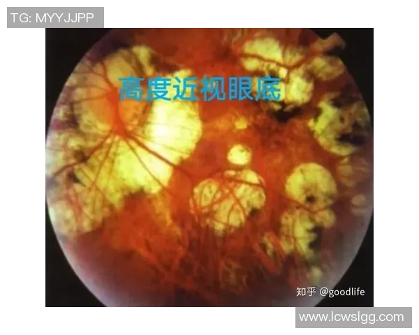 欧洲足球明星近视的原因探究与影响分析 欧洲足球明星近视的原因探究与影响分析